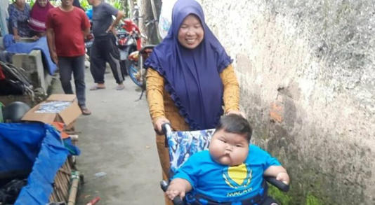Pemkab Bekasi Siapkan Bantuan Logistik untuk Kenzi Balita Obesitas yang Capai 27 Kilogram